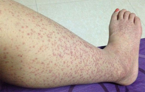 �����������ô���� ����Ӧע��ʲô